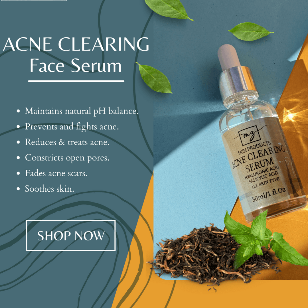 MZ Skin Acne Clearing Face Serum 30ml - TESTER